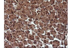 Image no. 5 for anti-Tripartite Motif Containing 44 (TRIM44) antibody (ABIN1501505) (TRIM44 anticorps)