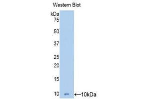 Western Blotting (WB) image for anti-Mucin 5 Subtype B (MUC5B) (AA 5366-5444) antibody (ABIN1078357) (MUC5B anticorps  (AA 5366-5444))