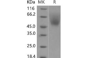Western Blotting (WB) image for Signal-Regulatory Protein alpha (SIRPA) (Active) protein (His tag) (ABIN7320097)