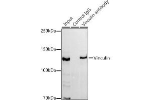 Immunoprecipitation analysis of 300 μg extracts of HeLa cells using 3 μg Vinculin antibody (ABIN3016604, ABIN3016605, ABIN1680530 and ABIN1680531). (Vinculin anticorps)