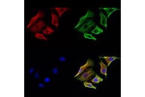 ABIN6265100 and ABIN6272929 staining Hela cells by IF/ICC. (SKAP2 anticorps  (C-Term))