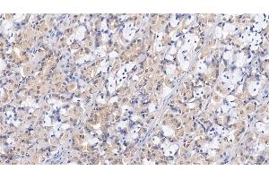 Detection of WTAP in Human Stomach Tissue using Polyclonal Antibody to Wilms Tumor 1 Associated Protein (WTAP) (WTAP anticorps  (AA 1-150))
