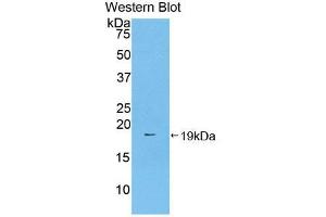 Western blot analysis of the recombinant protein. (Prothrombin anticorps  (AA 44-200))