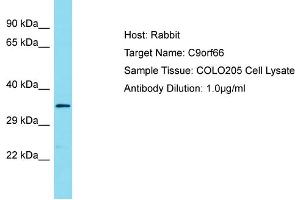 Host: Rabbit Target Name: C9ORF66 Sample Tissue: Human COLO205 Whole Cell Antibody Dilution: 1ug/ml (C9ORF66 anticorps  (C-Term))