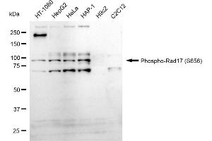 Western blotting analysis using Phospho-Rad17 (S656) antibody (ABIN7800113). (Recombinant RAD17 anticorps  (pSer656))