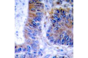 Immunohistochemical analysis of TNFAIP1 staining in human colon formalin fixed paraffin embedded tissue section.