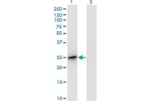 Western Blot analysis of DC-UbP expression in transfected 293T cell line by DC-UbP monoclonal antibody (M01), clone 1B8-1B1. (UBTD2 anticorps  (AA 1-190))