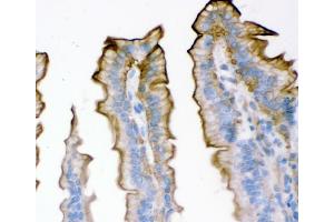 IHC analysis of Plectin using anti-Plectin antibody (ABIN3043900). (PLEC anticorps  (Middle Region))