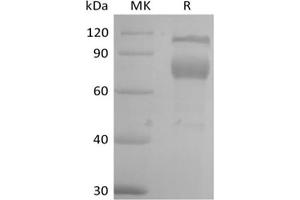 Western Blotting (WB) image for Interleukin 2 Receptor, beta (IL2RB) protein (Fc Tag) (ABIN7320916)