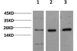Western Blotting (WB) image for anti-Chromobox Homolog 5 (CBX5) antibody (ABIN5957538) (CBX5 anticorps)