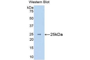 Western Blotting (WB) image for anti-Mannan-Binding Lectin serine Peptidase 2 (MASP2) (AA 22-142) antibody (ABIN1859765) (MASP2 anticorps  (AA 22-142))