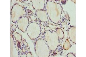Immunohistochemistry of paraffin-embedded human thyroid tissue using ABIN7163635 at dilution of 1:100 (PLEKHA1 anticorps  (AA 285-404))