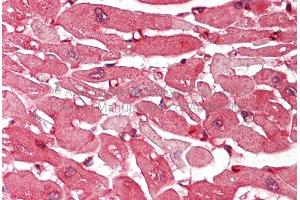 Rabbit Anti-ACTN2 antibody  Formalin Fixed Paraffin Embedded Tissue: Human Adult Heart  Observed Staining: Cytoplasm in hepatocytes Primary Antibody Concentration: 1:600 Secondary Antibody: Donkey anti-Rabbit-Cy3 Secondary Antibody Concentration: 1:200 Magnification: 20X Exposure Time: 0.