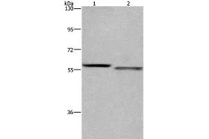Western Blot analysis of K562 and A431 cell using FRK Polyclonal Antibody at dilution of 1:1200 (FRK anticorps)