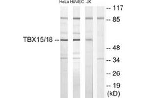 Western blot analysis of extracts from HuvEc/HeLa/Jurkat cells, using TBX15/18 Antibody. (T-Box 15/18 anticorps  (AA 161-210))
