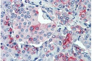 Anti-SLC11A2 antibody  ABIN1049329 IHC staining of human, pancreas. (SLC11A2 anticorps  (Internal Region))