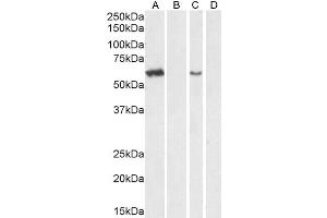 ABIN238536 (1 μg/mL) staining of Mouse Testes lysate (A) + peptide (B) and (0.
