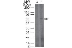 TRIF Western Blot.
