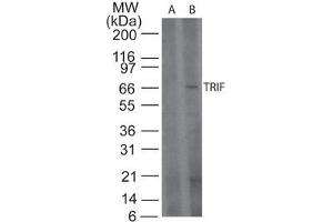 TRIF Western Blot. (TICAM1 anticorps)