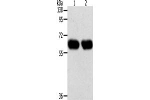 Gel: 10 % SDS-PAGE, Lysate: 40 μg, Lane 1-2: Lncap cells, SKOV3 cells, Primary antibody: ABIN7131276(SYT7 Antibody) at dilution 1/200, Secondary antibody: Goat anti rabbit IgG at 1/8000 dilution, Exposure time: 1 minute (SYT7 anticorps)