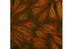 IF analysis of PDK2 using anti-PDK2 antibody (ABIN5693279) and anti-Tubulin Alpha antibody (ABIN7600339). (PDK2 anticorps  (AA 81-177))