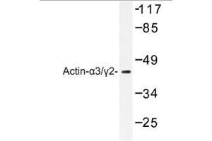Image no. 1 for anti-Actin, gamma 2, Smooth Muscle, Enteric (ACTG2) antibody (ABIN265300) (ACTG2 anticorps)