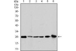 Western blot analysis using GSTM1 mouse mAb against MCF-7 (1), PC-12 (2), Jurkat (3), Hela (4), HL7702 (5) and HepG2 (6) cell lysate. (GSTM1 anticorps)