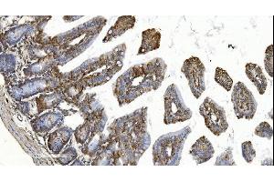 IHC analysis of YTHDF2 using anti-YTHDF2 antibody (ABIN7603191). (YTHDF2 anticorps  (N-Term))