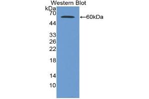 Western blot analysis of the recombinant protein. (Glucose-6-Phosphate Dehydrogenase anticorps  (AA 1-515))