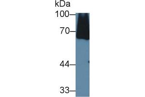 Detection of C8a in Mouse Serum using Polyclonal Antibody to Complement Component 8a (C8a) (C8A anticorps  (AA 21-300))