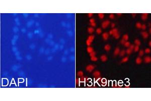 Immunofluorescence analysis of 293T cells using TriMethyl-Histone H3-K9 antibody. (Histone 3 anticorps  (H3K9me3))
