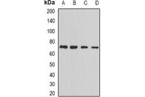 Western blot analysis of PRC1 expression in MCF7 (A), Jurkat (B), Hela (C), HepG2 (D) whole cell lysates. (PRC1 anticorps)