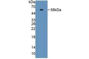 Western blot analysis of recombinant Mouse SPTLC3. (SPTLC3 anticorps  (AA 80-563))