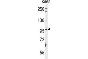 Western Blotting (WB) image for anti-Taste Receptor, Type 1, Member 2 (TAS1R2) antibody (ABIN2996356) (TAS1R2 anticorps)