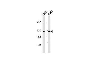 All lanes : Anti-ZFYVE20 Antibody (N-Term) at 1:8000 dilution Lane 1: Hela whole cell lysates Lane 2: K562 whole cell lysates Lysates/proteins at 20 μg per lane.