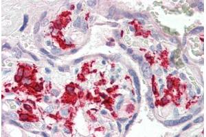 Human Placenta (formalin-fixed, paraffin-embedded) stained with AIF1 antibody ABIN337129 at 2. (Iba1 anticorps  (AA 42-56))