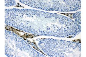 IHC analysis of CPI17 alpha using anti- CPI17 alpha antibody .