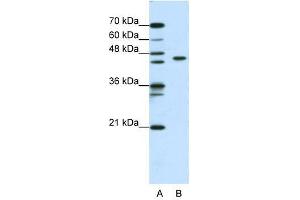 ZBTB9 antibody used at 0. (ZBTB9 anticorps  (N-Term))