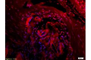 Formalin-fixed and paraffin embedded rat colitis tissue labeled with Anti CTHRC1 Polyclonal Antibody, Unconjugated (ABIN759281) at 1:200 followed by conjugation to the secondary antibody Goat Anti-Rabbit IgG, Cy3 conjugated used at 1:200 dilution for 40 minutes at 37°C and DAPI staining (CTHRC1 anticorps  (AA 31-130))