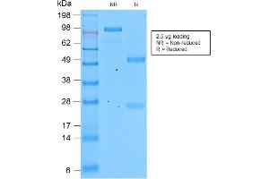 SDS-PAGE Analysis of Purified Involucrin Rabbit Recombinant Monoclonal Antibody (IVRN/2113R). (Recombinant Involucrin anticorps)