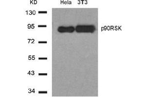 Image no. 1 for anti-Ribosomal Protein S6 Kinase, 90kDa, Polypeptide 1 (RPS6KA1) (Thr348) antibody (ABIN197328)