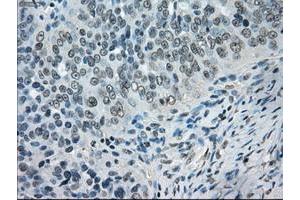 Image no. 6 for anti-Crystallin, alpha B (CRYAB) antibody (ABIN1497645) (CRYAB anticorps)