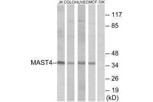 Western blot analysis of extracts from Jurkat cells, COLO cells, HUVEC cells and MCF-7 cells, using MAST4 antibody. (MAST4 anticorps)