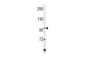 Western blot analysis of COL6A1 antibody in Y79 cell line lysates (35ug/lane) (COL6A1 anticorps  (C-Term))