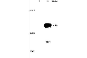 Lane 1: rat brain lysates Lane 2: human colon carcinoma lysates probed with Anti ROCK2 Polyclonal Antibody, Unconjugated (ABIN673359) at 1:200 in 4C. (ROCK2 anticorps  (AA 1001-1300))