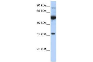 EIF2B1 antibody used at 1 ug/ml to detect target protein. (EIF2B1 anticorps  (C-Term))