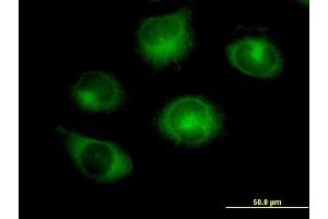 Immunofluorescence of purified MaxPab antibody to RABGAP1 on HeLa cell. (RABGAP1 anticorps  (AA 1-997))