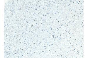 ABIN185467 Negative Control showing staining of paraffin embedded Human Cortex, with no primary antibody.