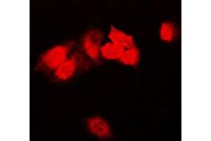 Immunofluorescent analysis of Focal Adhesion Kinase staining in HeLa cells. (FAK anticorps  (Center))