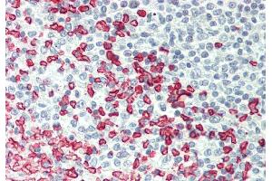 Rabbit Anti-ERMAP antibody  Formalin Fixed Paraffin Embedded Tissue: Human Spleen Primary antibody Concentration: 1:100 Secondary Antibody: Donkey anti-Rabbit-Cy3 Secondary Antibody Concentration: 1:200 Magnification: 20x Exposure Time: 0.